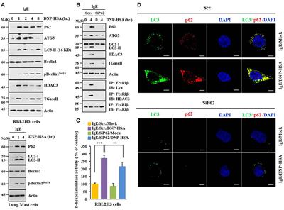 MiR-135-5p-p62 Axis Regulates Autophagic Flux, Tumorigenic Potential, and Cellular Interactions Mediated by Extracellular Vesicles During Allergic Inflammation